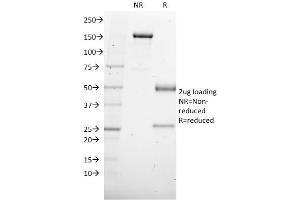 SDS-PAGE Analysis Purified SOX4 Mouse Monoclonal Antibody (SOX4/2540). (SOX4 抗体)