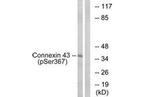 Western blot analysis of extracts from K562 cells treated with PMA 200ng/ml 10', using Connexin 43 (Phospho-Ser367) Antibody. (Connexin 43/GJA1 抗体  (pSer367))