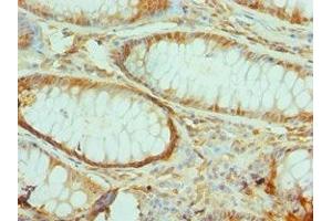 Immunohistochemistry (IHC) image for anti-Toll-Interleukin 1 Receptor (TIR) Domain Containing Adaptor Protein (TIRAP) (AA 1-221) antibody (ABIN7172290)