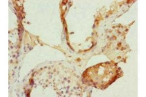 Immunohistochemistry of paraffin-embedded human testis tissue using ABIN7152485 at dilution of 1:100 (FBXL5 抗体  (AA 1-310))