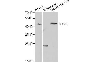 Western blot analysis of extracts of various cell lines, using GGT1 antibody. (GGT1 抗体  (AA 370-569))