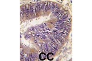 Immunohistochemistry (IHC) image for anti-Suppression of Tumorigenicity 13 (ST13) antibody (ABIN2971014) (HSC70 Interacting Protein HIP 抗体)