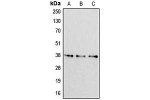 Western blot analysis of Apolipoprotein F expression in HeLa (A), NIH3T3 (B), H9C2 (C) whole cell lysates. (Apolipoprotein F 抗体  (C-Term))