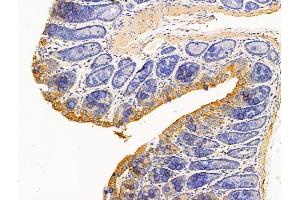 ABIN7094721 and ABIN7098772 at 1/100 staining Rat colorectal tissue by IHC-P.