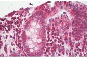 Image no. 2 for anti-NLR Family, Pyrin Domain Containing 3 (NLRP3) (AA 158-207) antibody (ABIN6749780) (NLRP3 抗体  (AA 158-207))