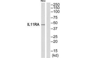 Western Blotting (WB) image for anti-Interleukin 11 Receptor, alpha (IL11RA) (C-Term) antibody (ABIN1852556) (IL11RA 抗体  (C-Term))