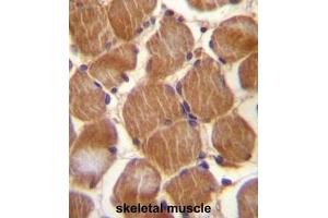 ASAM Antibody (Center) immunohistochemistry analysis in formalin fixed and paraffin embedded human skeletal muscle followed by peroxidase conjugation of the secondary antibody and DAB staining. (CLMP 抗体  (Middle Region))