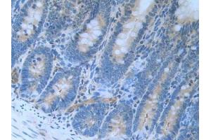 Detection of LXN in Rat Stomach Tissue using Polyclonal Antibody to Latexin (LXN)