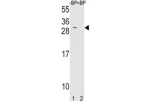 Western Blotting (WB) image for anti-TIMP Metallopeptidase Inhibitor 3 (TIMP3) antibody (ABIN3004040) (TIMP3 抗体)