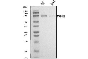 Western blot analysis of MAP4K1/HPK1 using anti-MAP4K1/HPK1 antibody (ABIN7601232).