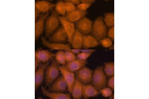 Immunofluorescence (IF) image for anti-Zinc Finger CCCH-Type Containing 7A (ZC3H7A) (AA 1-220) antibody (ABIN6150400)