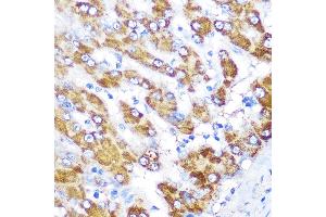 Immunohistochemistry of paraffin-embedded human liver using GATM Rabbit pAb (ABIN6133283, ABIN6140984, ABIN6140985 and ABIN6222282) at dilution of 1:100 (40x lens). (GATM 抗体  (AA 124-423))