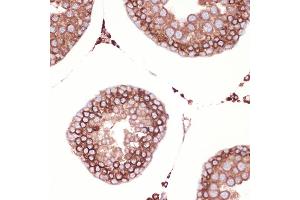 Immunohistochemistry of paraffin-embedded rat testis using Peroxiredoxin 4 (PRDX4) (PRDX4) Rabbit mAb (ABIN7269238) at dilution of 1:100 (40x lens). (Peroxiredoxin 4 抗体)