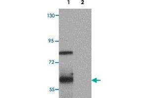 Western blot analysis of TYW1 in human lung tissue lysate with TYW1 polyclonal antibody  at 1 ug/mL. (TYW1 抗体  (C-Term))