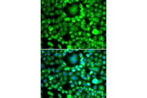 Immunofluorescence analysis of MCF-7 cells using BLID antibody (ABIN5974377). (BLID 抗体)