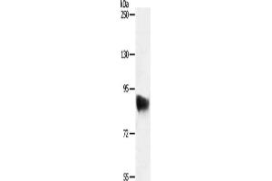Gel: 8 % SDS-PAGE, Lysate: 50 μg, Lane: Jurkat cells, Primary antibody: ABIN7130996(SEMA3G Antibody) at dilution 1/400, Secondary antibody: Goat anti rabbit IgG at 1/8000 dilution, Exposure time: 30 minutes
