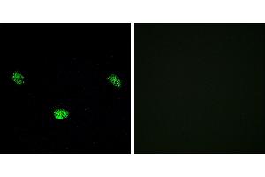 P-peptide - +Immunofluorescence analysis of LOVO cells, using HNF4α (Phospho-Ser313) antibody. (HNF4A 抗体  (pSer313))