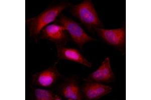 Immunofluorescence (IF) image for anti-B-Cell CLL/lymphoma 2 (BCL2) antibody (ABIN567617) (Bcl-2 抗体)