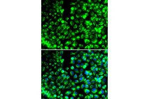 Immunofluorescence analysis of HeLa cells using CALU antibody (ABIN6291516). (CALU 抗体)