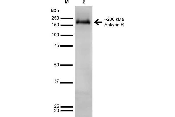 Erythrocyte Ankyrin 抗体  (AA 1-1881)