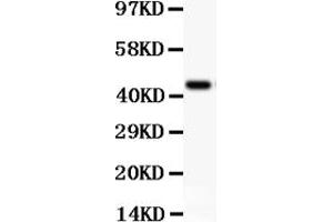 Western blot analysis of CD11b using anti-CD11b antibody (ABIN3043258). (CD11b 抗体  (AA 17-382))