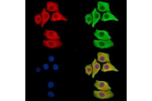 ABIN7096068 and ABIN7100130 staining Hela cells by IF/ICC.