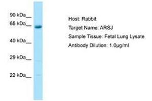 Image no. 1 for anti-Arylsulfatase J (ARSJ) (C-Term) antibody (ABIN6750084) (ARSJ 抗体  (C-Term))