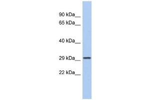 CACNG6 antibody used at 1 ug/ml to detect target protein. (CACNG6 抗体  (N-Term))