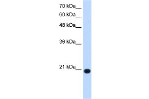 UXT antibody used at 1. (UXT 抗体  (N-Term))