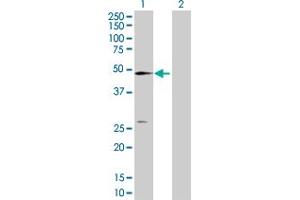 Western Blot analysis of NT5C2 expression in transfected 293T cell line by NT5C2 MaxPab polyclonal antibody. (NT5C2 抗体  (AA 1-561))
