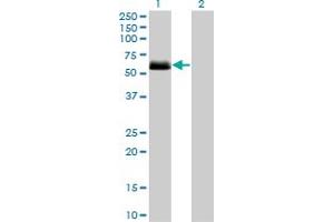 Western Blot analysis of CSNK1G2 expression in transfected 293T cell line by CSNK1G2 monoclonal antibody (M08), clone 2F5. (Casein Kinase 1 gamma 2 抗体  (AA 315-415))