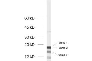 dilution: 1 : 1000, sample: rat brain homogenate (VAMP1, 2, 3 (AA 1-81) 抗体)