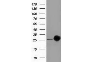 Western Blotting (WB) image for anti-ClpP Caseinolytic Peptidase, ATP-Dependent, Proteolytic Subunit Homolog (E. Coli) (CLPP) antibody (ABIN2718668)
