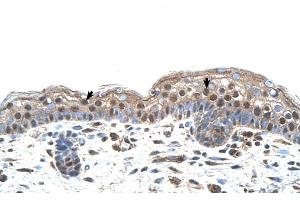 Human Skin (IRF4 抗体  (N-Term))