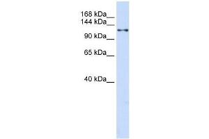Western Blot showing XPO5 antibody used at a concentration of 1-2 ug/ml to detect its target protein. (XPO5 抗体  (N-Term))