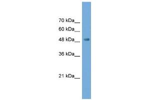 WB Suggested Anti-NPTX2 Antibody Titration: 0. (NPTX2 抗体  (N-Term))