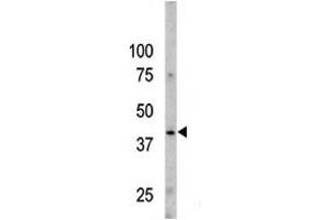 Image no. 1 for anti-Caspase 9, Apoptosis-Related Cysteine Peptidase (CASP9) (pSer196) antibody (ABIN358092) (Caspase 9 抗体  (pSer196))