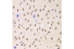 Immunohistochemistry of paraffin-embedded mouse brain using PRPF3 Antibody (ABIN1876670) at dilution of 1:100 (40x lens). (PRPF3 抗体)