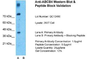 Host: Rabbit  Target Name: ABCB4  Sample Tissue: 293T Whole Cell  Lane A:  Primary Antibody Lane B: Primary Antibody + Blocking Peptide Primary Antibody Concentration: 1 µg/mL Peptide Concentration: 9 µg/mL Lysate Quantity: 941 µg/lane/LaneGel Concentration: 9. (ABCB4 抗体  (N-Term))