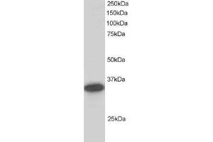Image no. 3 for anti-Carbonyl Reductase 1 (CBR1) (C-Term) antibody (ABIN184784)