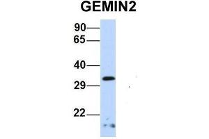 Host:  Rabbit  Target Name:  GEMIN2  Sample Type:  Human 721_B  Antibody Dilution:  1. (SIP1 抗体  (Middle Region))