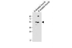 Western Blotting (WB) image for anti-Solute Carrier Family 16 (Monocarboxylic Acid Transporters), Member 3 (SLC16A3) (AA 433-462), (C-Term) antibody (ABIN656331)