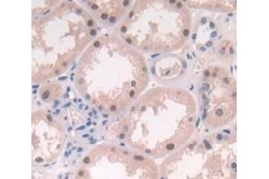 IHC-P analysis of Human Tissue, with DAB staining. (LRRFIP1 抗体  (AA 128-250))