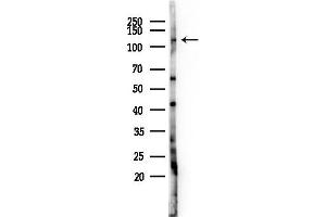 Western blot analysis of lysates from HUVEC cells(LPS 4h treatment), using JADE2 Antibody at 1/1000 dilution.