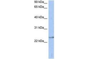 Image no. 1 for anti-ATPase, H+ Transporting, Lysosomal 31kDa, V1 Subunit E2 (ATP6V1E2) (AA 71-120) antibody (ABIN6744287)
