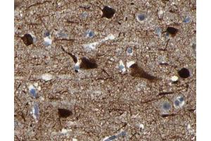 Immunohistochemistry (IHC) image for anti-Microtubule-Associated Protein 2 (MAP2) (N-Term) antibody (ABIN6263097)
