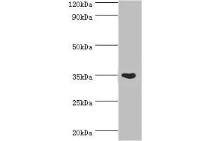 Western blot All lanes: Arginase-1 antibody at 3 μg/mL + Mouse liver tissue Secondary Goat polyclonal to rabbit IgG at 1/10000 dilution Predicted band size: 35, 36, 26 kDa Observed band size: 35 kDa (Liver Arginase 抗体  (AA 1-322))
