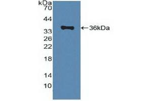 Detection of Recombinant ABCA1, Human using Polyclonal Antibody to ATP Binding Cassette Transporter A1 (ABCA1) (ABCA1 抗体  (AA 1385-1663))
