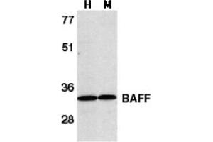 Image no. 2 for anti-Tumor Necrosis Factor (Ligand) Superfamily, Member 13b (TNFSF13B) (C-Term) antibody (ABIN204251) (BAFF 抗体  (C-Term))
