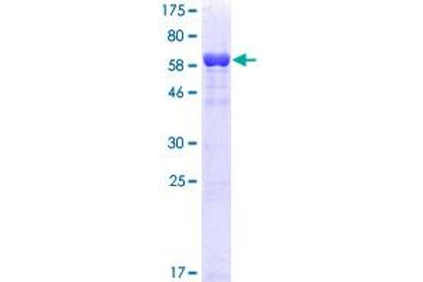 RRM2 Protein (AA 1-389) (GST tag)